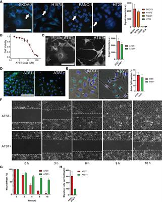 Statins Lower Lipid Synthesis But Promote Secretion of Cholesterol-Enriched Extracellular Vesicles and Particles